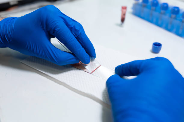 istock scientist prepare blood sample for research on microscope. Placing blood sample on microscope slide. Science and medicine concept 1147784122