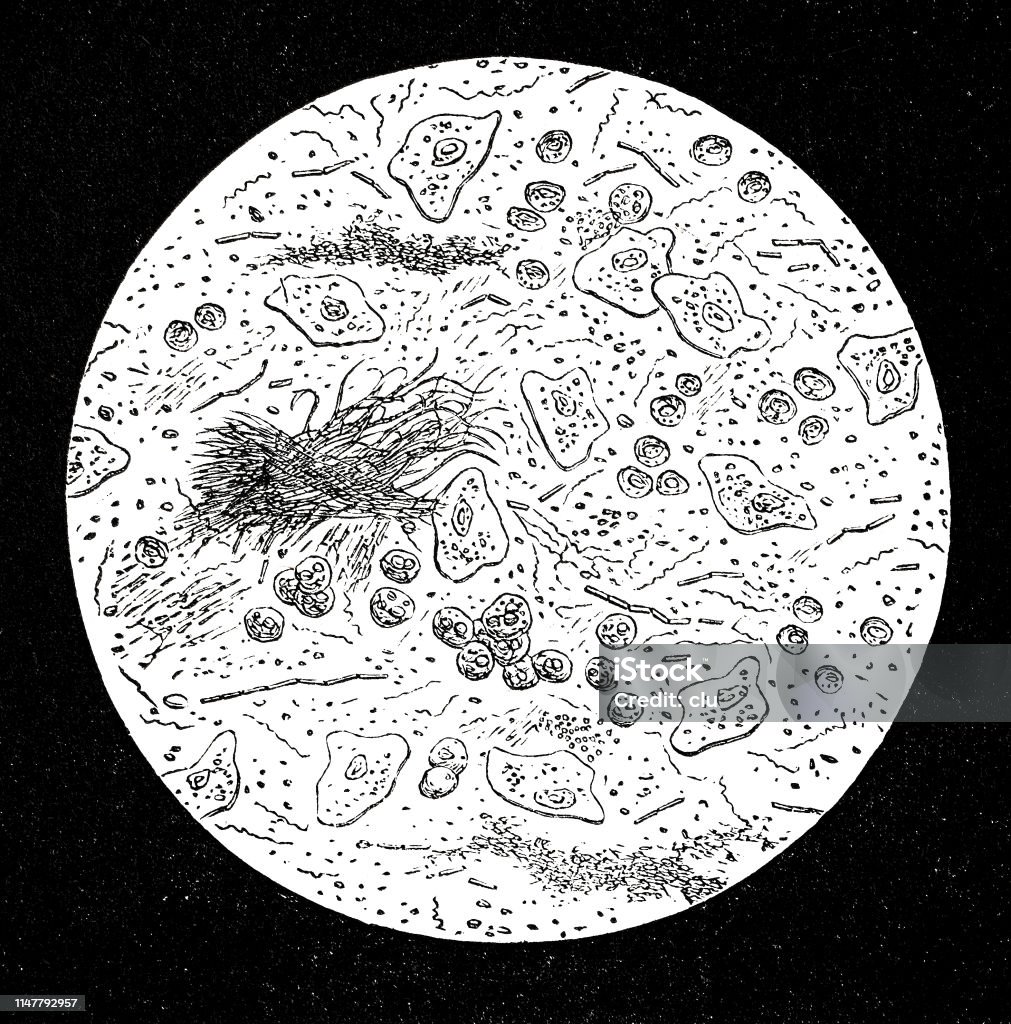 Dental mucus under the microscope Illustration from 19th century Black And White stock illustration