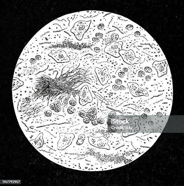 Dental Mucus Under The Microscope Stock Illustration - Download Image Now - Black And White, Mucus, 19th Century