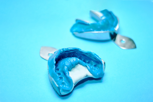 Two dental impressions on a blue background with copy space. Dental molds from the upper and lower jaws of silicone material. The imprint of the tooth row of high precision.