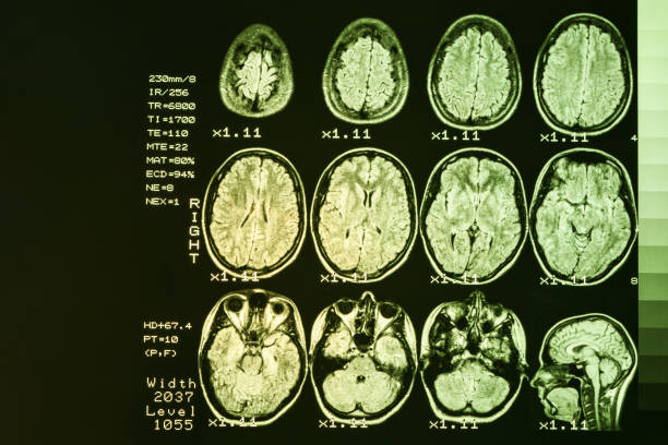mri scan or magnetic resonance image of head and brain scan. the result is an mri of the brain with values and numbers with yellow backlight. - brain mri scanner mri scan medical scan imagens e fotografias de stock