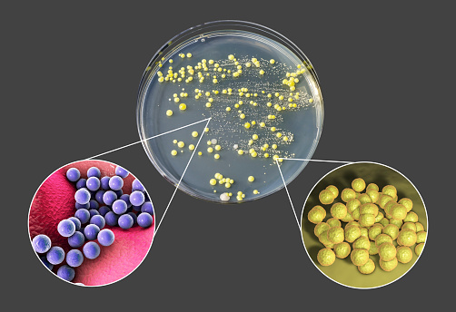 Colonies of bacteria grown from human skin smear, Staphylococcus epidermidis, left, and Micrococcus luteus, right, photo and 3D illustration