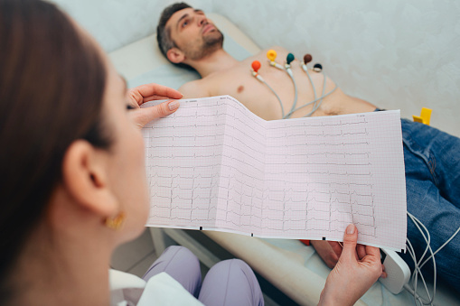 paciente recibiendo frecuencia cardíaca monitoreada en el hospital. Close-up del informe ECG photo