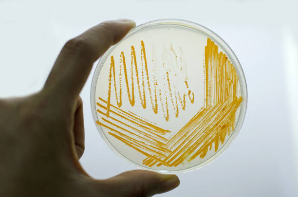 istock Orange colonies of Actinomyces bacteria on agar plate 1148232216