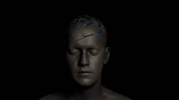 istock Brain tumor or brain cancer 1148283109