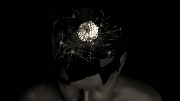 istock Brain tumor or brain cancer 1148284201