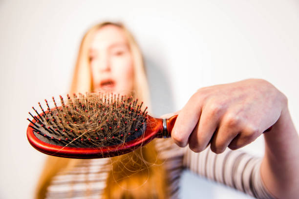 istock Woman have problem of hair loss 1148301486
