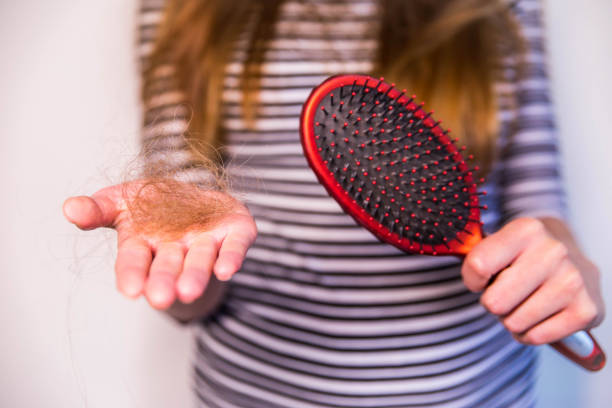 Woman have problem of hair loss