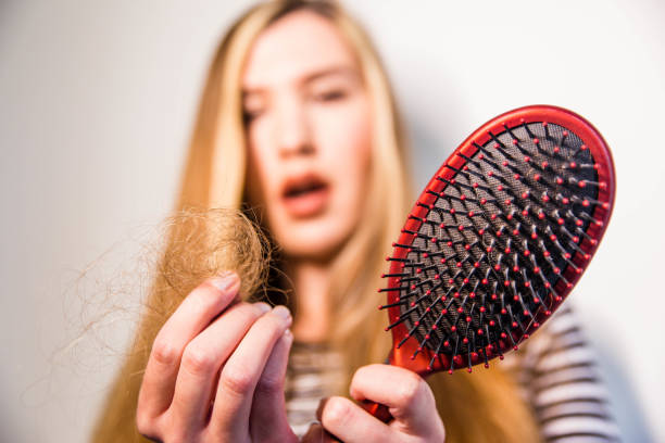 istock Seasonal Hair Loss 1148301539