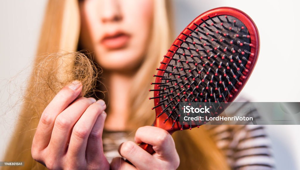 Woman have problem of hair loss Alopecia Stock Photo