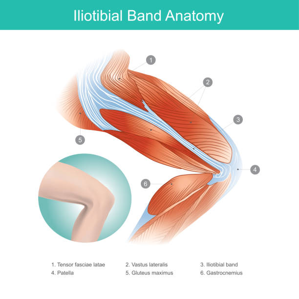 illustrazioni stock, clip art, cartoni animati e icone di tendenza di anatomia della banda iliotibiale. illustrazione. - pain human knee arthritis human joint