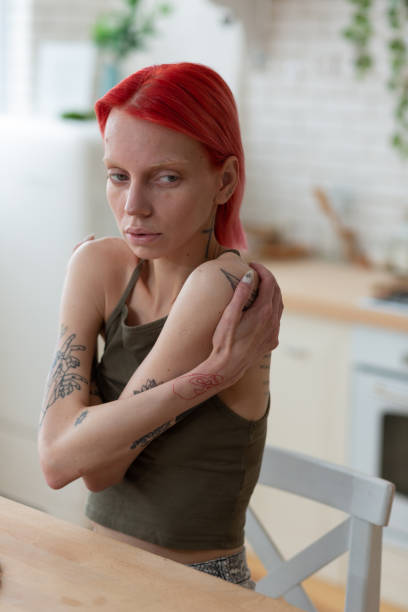 istock Woman suffering from anorexia touching her shoulders 1148339849