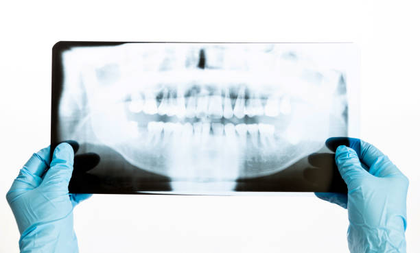 dentiste retenant une radiographie sur le fond blanc - x ray x ray image human hand anatomy photos et images de collection