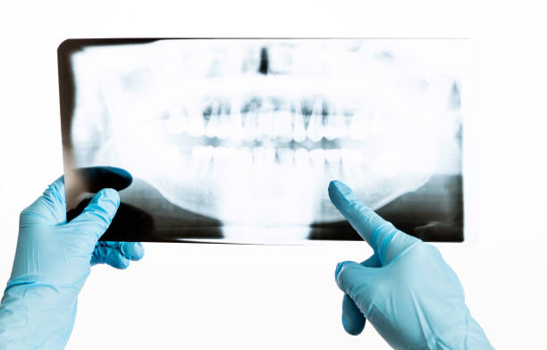 istock Dentist holding an x-ray on white background 1148535662