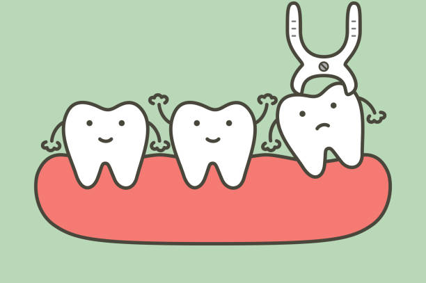 Tooth Extraction By Dental Tools To Remove Wisdom Tooth Stock Illustration - Download Image Now - iStock Tooth Extraction By Dental Tools To Remove Wisdom Tooth Stock Illustration - Download Image Now - iStock