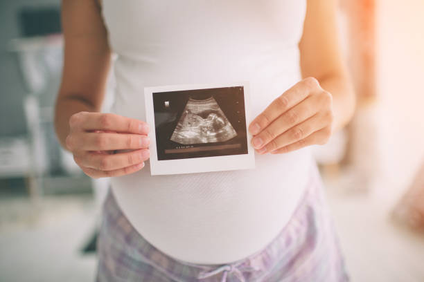 pregnant woman holding ultrasound scan. concept of pregnancy health care - abdomen women loving human hand imagens e fotografias de stock