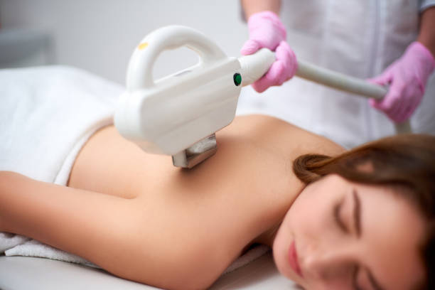 depilação traseira consideravelmente nova do laser da mulher de sorriso no salão de beleza. cosmetologista fazendo tratamento depilação com dispositivo elos. as mãos de beautician nas luvas que prendem a remoção do cabelo cosmetology ipl hardware - friends life t20 - fotografias e filmes do acervo