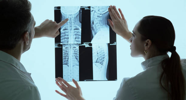 두 명의 의사가 환자 x 선 및 mri 스캔, 흉부 엑스레이를 논의 합니다. - human spine mri scan x ray doctor 뉴스 사진 이미지