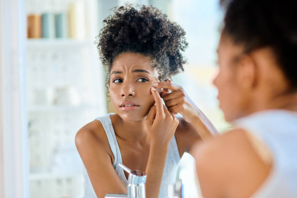istock Bring out the anti pimple cream 1149185163