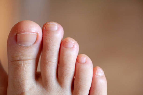 istock Men's toes, healthy toe nails 1149198406