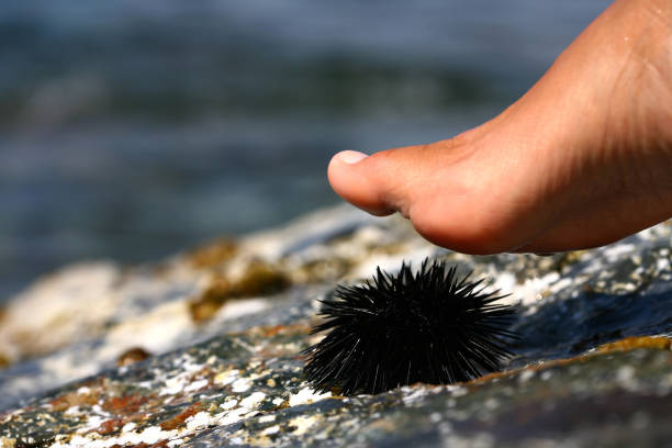 walk on a sea urchin walk on a sea urchin at the beach sea urchin stock pictures, royalty-free photos & images