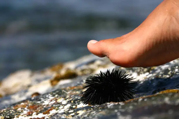 walk on a sea urchin at the beach
