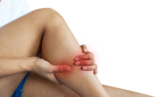 센시아 가격 효능3 부작용 정맥순환 증상(다리가 붓고 저리다면)복용법 정리 9 %EB%8B%A4%EB%A6%AC %ED%86%B5%EC%A6%9D %EA%B3%A0%EB%A6%BD %EB%90%9C %EB%B0%B0%EA%B2%BD%EC%9D%84 %EA%B0%80%EC%A7%84 %EC%97%AC%EC%9E%90