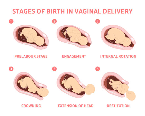 Stages of baby birth in vaginal delivery Stages of baby birth in vaginal delivery. Fetus movement during the labor. Biology and gynecology. Isolated vector illustration pregnancy and childbirth stock illustrations