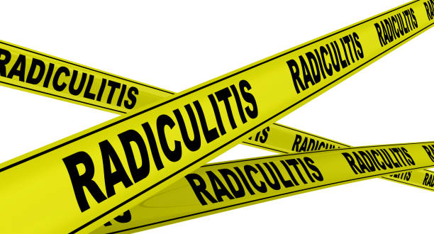 istock Radiculitis. Yellow warning tapes 1149860409