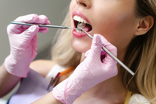 Close-up de boca abierta durante los dientes de chequeo oral en la oficina del dentista. Macro toma de dientes blancos de mujer joven. Concepto de odontología photo