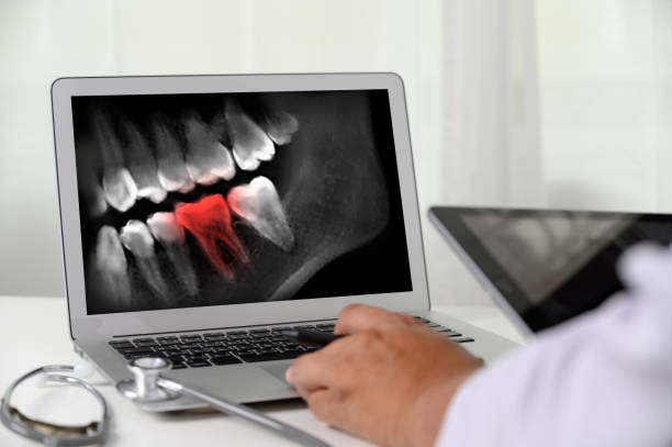 istock Dentist dental tool to teeth x-ray work Looking At Teeth X-ray On Computer 1150036073