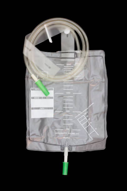 fermez le sac de collecte d’urine en plastique accrocher sur le fond noir avec le chemin de cipping - foley photos et images de collection