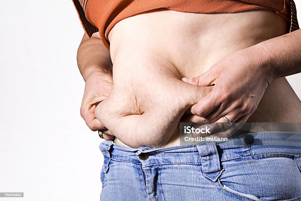 Celulite na Barriga - Royalty-free Alimentação Não-saudável Foto de stock