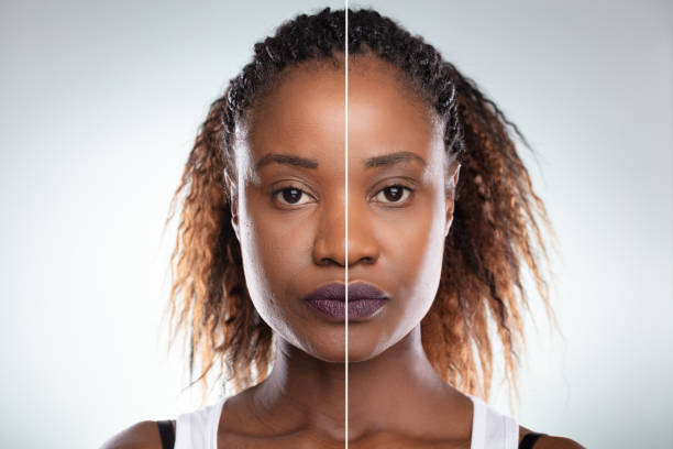 istock Woman's Face Before And After Cosmetic Procedure 1150345612