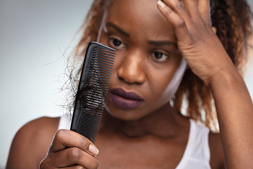 Mujer conmocionada que sufre de pérdida de cabello problema photo