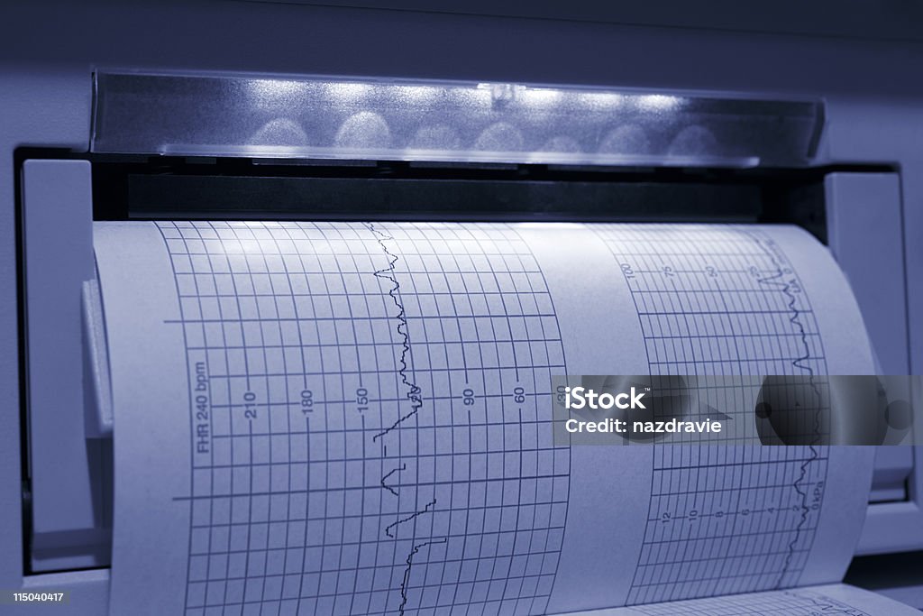 태아 아기 심박계 EKG 프린트아웃 블루 틴트 - 로열티 프리 0명 스톡 사진