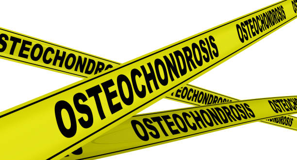 istock Osteochondrosis. Yellow warning tapes 1150708274