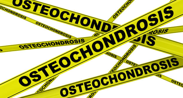 istock Osteochondrosis. Yellow warning tapes 1150708275