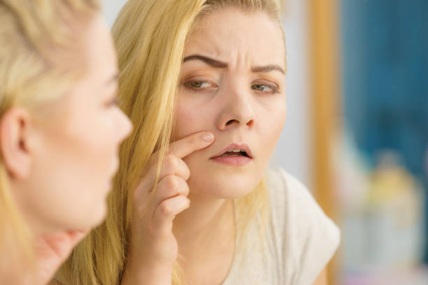 istock Woman looking at her skin in mirror 1150752954