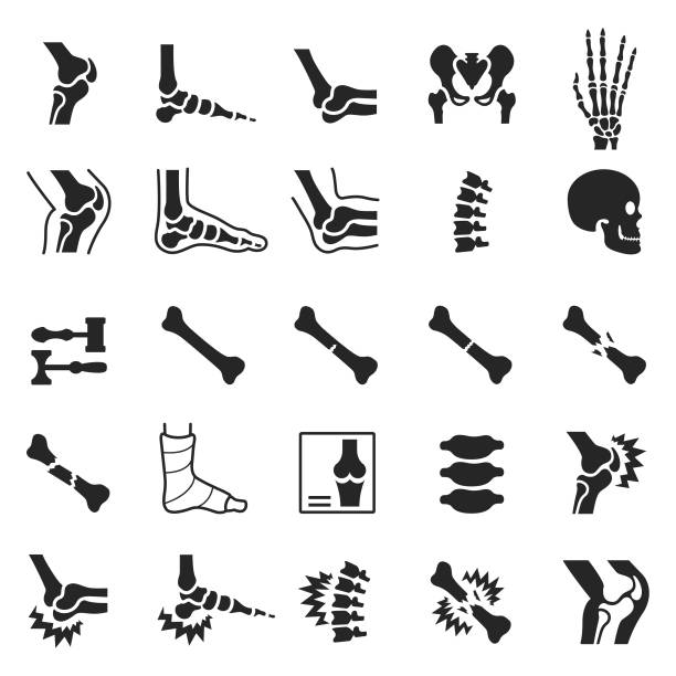 orthopädische icon-set - knochen stock-grafiken, -clipart, -cartoons und -symbole