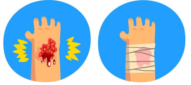 傷ついた手、身体的なけが、応急処置と治療ベクトルのイラストを白い背景に - wound blood human finger physical injury点のイラスト素材／クリップアート素材／マンガ素材／アイコン素材