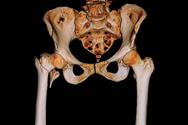 mri 股関節骨折。骨盤骨と coxofemoral 関節 - cat scan pelvis hip human spine ストックフォトと画像