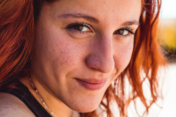 istock redhead girl in the park 1150917958