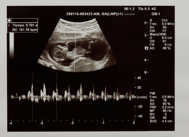 Ultrasound scan of future baby Ultrasound scan of future baby with heart beat parameters fetus photos stock pictures, royalty-free photos & images