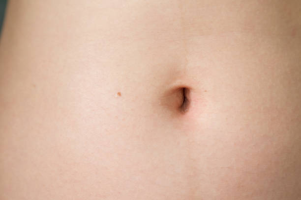 istock Woman belly skin 1151099986