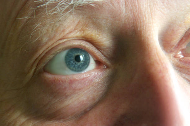 istock Eye of middle aged man - close up - looking upwards 1151153295