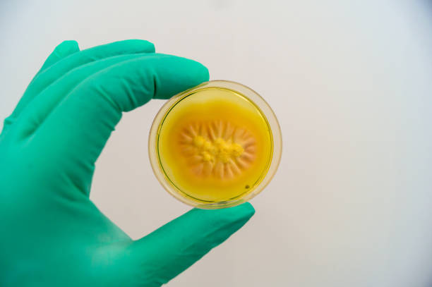 istock Mold grown on a Sabouraud agar medium in a Petri dish 1151185615