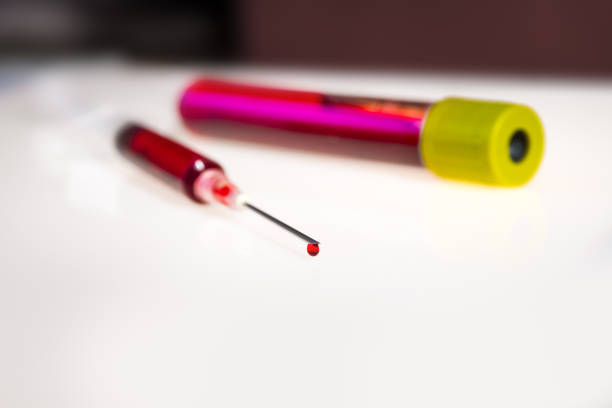 istock Syringe needle and tube with blood 1151373029