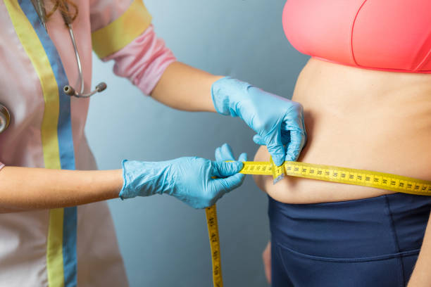 доктор принимая тучное измерение жировых отложений женщины - overweight tummy tuck abdomen body стоковые фото и изображения