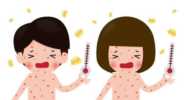 Children has chicken pox , kids fever and chickenpox symptoms and prevention. sick man and woman with fever and red rash, boy and girl Measles,Health care cartoon character vector illustration Children has chicken pox , kids fever and chickenpox symptoms and prevention. sick man and woman with fever and red rash, boy and girl Measles,Health care cartoon character vector illustration measles illustrations stock illustrations